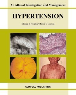 Hypertension An Atlas Of Investigation And Management 1st Edition Edward D Frohlich