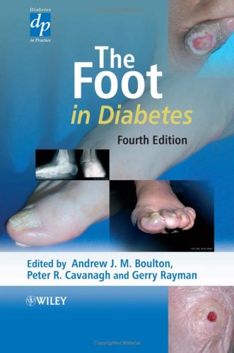 The Foot In Diabetes 4th Edition 4th Edition Andrew James Michael Boulton