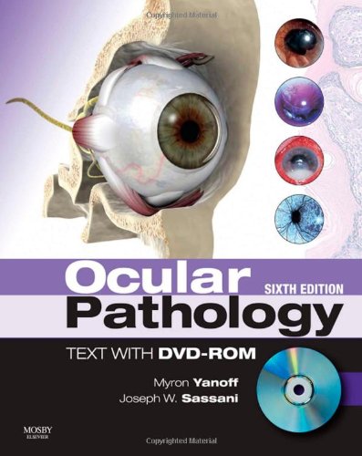Ocular Pathology 6th Edition 6th Edition Myron Yanoff Md Joseph W Sassani Md Mha