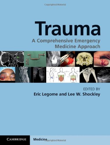 Trauma A Comprehensive Emergency Medicine Approach 1st Edition Eric Legome