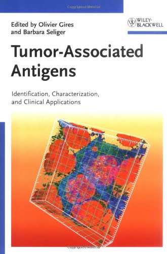 Tumorassociated Antigens Identification Characterization And Clinical Applications 1st Edition Olivier Gires