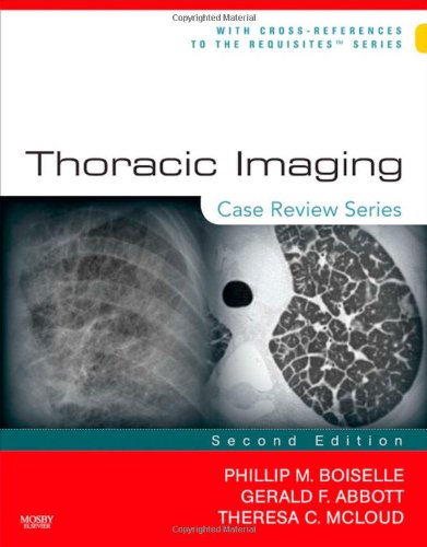 Thoracic Imaging Case Review Series 2nd Edition 2nd Edition Phillip M Boiselle Md