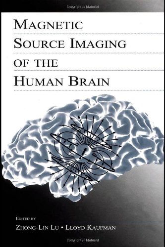 Magnetic Source Imaging Of The Human Brain 1st Edition Zhonglin Lu