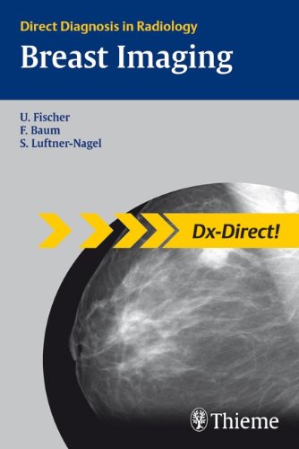 Breast Imaging Dxdirect 1st Edition Uwe Fischer Friedemann Baum