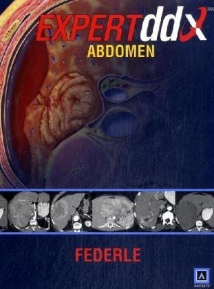 Expertddx Abdomen Expertddx 1st Edition Michael P Federle