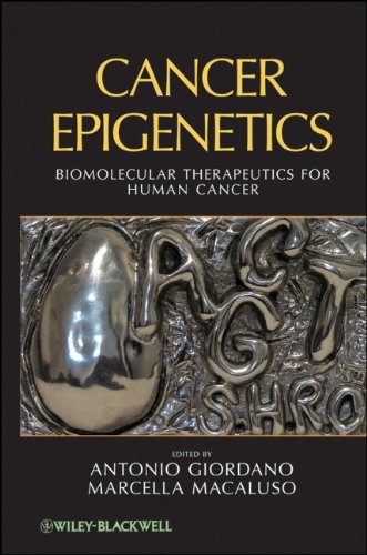 Cancer Epigenetics Biomolecular Therapeutics For Human Cancer 1st Edition Antonio Giordano