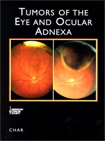 Tumors Of The Eye And Ocular Adnexa Atlas Of Clinical Oncology 1st Edition Devron H Char