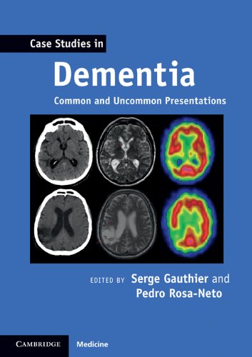 Case Studies In Dementia Common And Uncommon Presentations Case Studies In Neurology 1st Edition Serge Gauthier