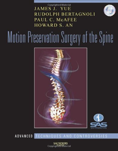 Motion Preservation Surgery Of The Spine Advanced Techniques And Controversies 1 Hardvd James J Yue Md
