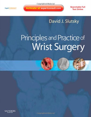 Principles And Practice Of Wrist Surgery 1 Hardvd David J Slutsky Md Frcs