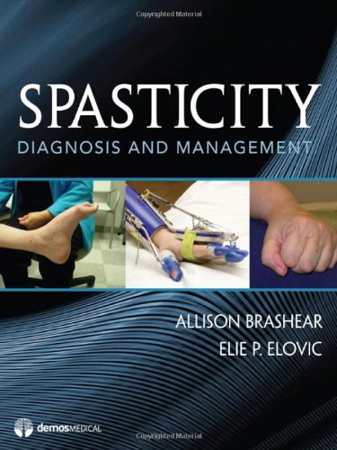 Spasticity Diagnosis And Management 1st Edition Allison Brashear