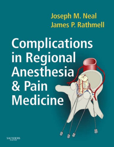 Complications In Regional Anesthesia And Pain Medicine 1st Edition Joseph M Neal Md