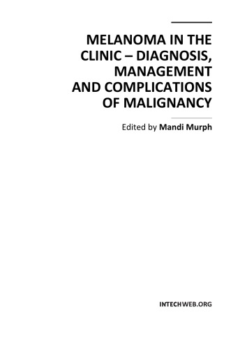 Melanoma In The Clinic Diagnosis Management And Complications Of Malignancy Mandi Murph