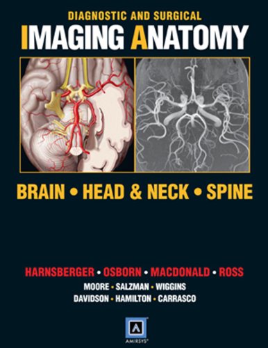 Diagnostic And Surgical Imaging Anatomy Brain Head And Neck Spine Published By Amirsys Int H Ric Harnsberger