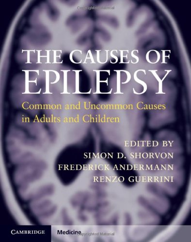 The Causes Of Epilepsy Common And Uncommon Causes In Adults And Children 1st Edition Simon D Shorvon