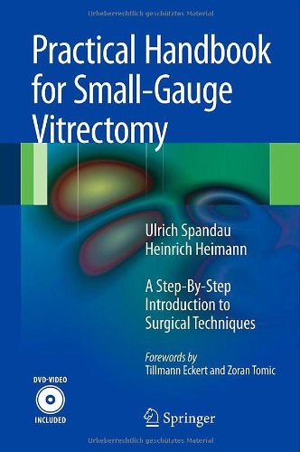 Practical Handbook For Smallgauge Vitrectomy A Stepbystep Introduction To Surgical Techniques 1st Edition Ulrich Spandau