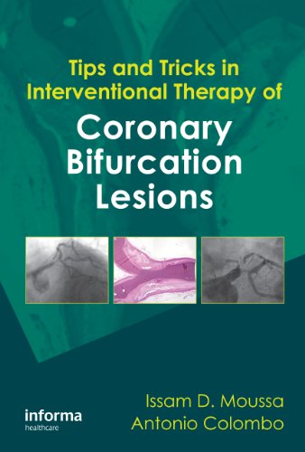 Tips And Tricks In Interventional Therapy Of Coronary Bifurcation Lesions 1st Edition Issam D Moussa