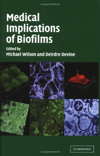 Medical Implications Of Biofilms Michael Wilson Deirdre Devine