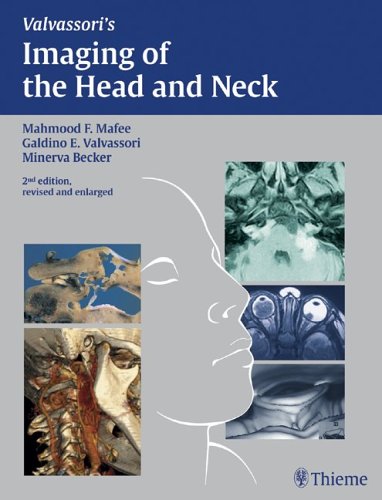 Imaging Of The Head And Neck 2nd Edition 2nd Edition Mahmood F Mafee