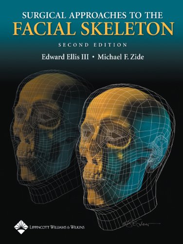 Surgical Approaches To The Facial Skeleton Second Edition 2nd Edition Edward Ellis