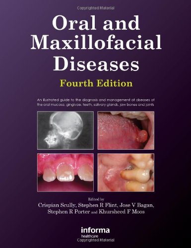 Oral And Maxillofacial Diseases 4th Edition 4 Ill Crispian Scully