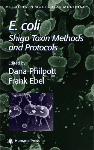 E Coli Shiga Toxin Methods And Protocols Methods In Molecular Medicine Dana Philpott