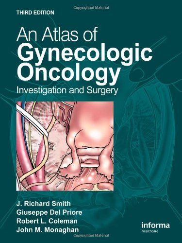 An Atlas Of Gynecologic Oncology Third Edition Investigation And Surgery 3rd Edition J Richard Smith