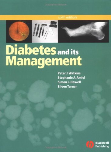 Diabetes And Its Management 6th Edition 6th Edition Peter J Watkins