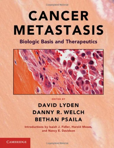 Cancer Metastasis Biologic Basis And Therapeutics 1st Edition David Lyden