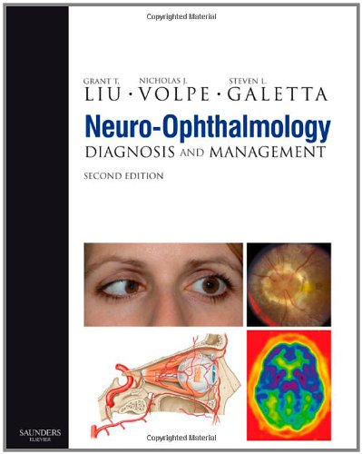 Neuroophthalmology Diagnosis And Management Second Edition Second Edition Grant T Liu Md