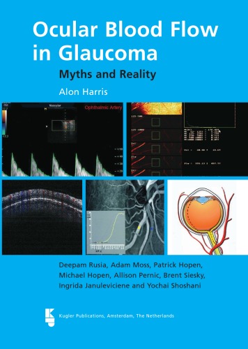 Ocular Blood Flow In Glaucoma Myths And Reality Alon Harris Deepam Rusia