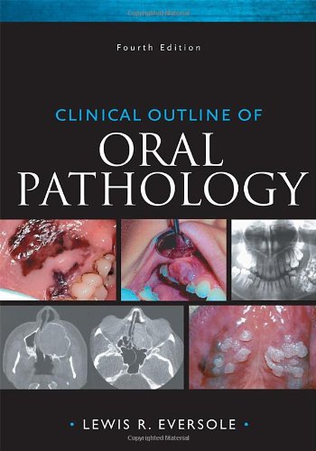 Clinical Outline Of Oral Pathology Diagnosis And Treatment 4th Edition Lewis R Eversole