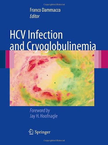 Hcv Infection And Cryoglobulinemia 1st Edition Franco Dammacco