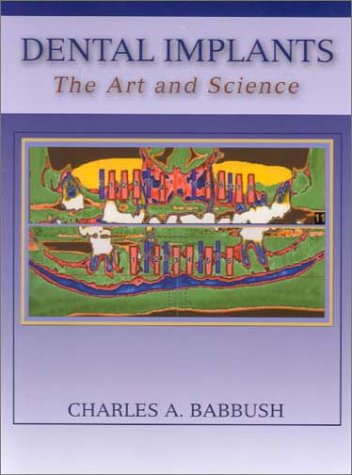 Dental Implants The Art And Science 2nd Edition Charles A Babbush Dds Mscd