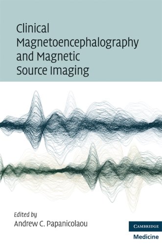 Clinical Magnetoencephalography And Magnetic Source Imaging 1st Edition Andrew C Papanicolaou