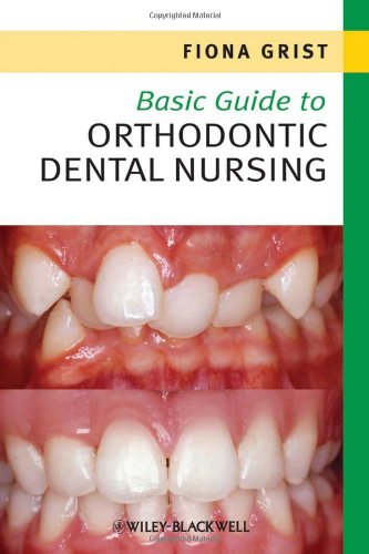 Basic Guide To Orthodontic Dental Nursing Basic Guide Dentistry Series 1st Edition Fiona Grist