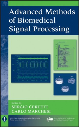 Advanced Methods Of Biomedical Signal Processing Ieee Press Series On Biomedical Engineering 1st Edition Sergio Cerutti