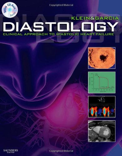 Diastology Clinical Approach To Diastolic Heart Failure 1 Harcdr Allan L Klein Md