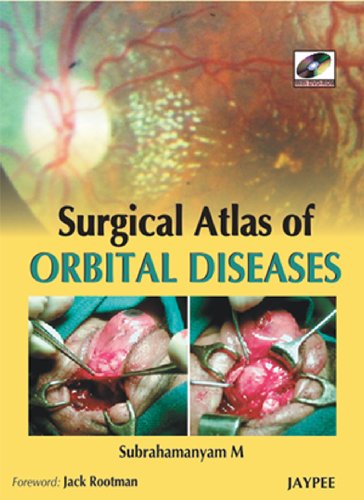 Surgical Atlas Of Orbital Diseases 1st Edition Mallajosyulla
