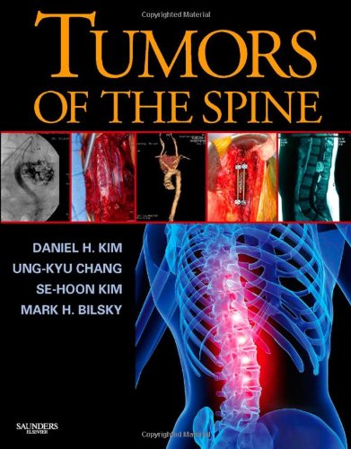 Tumors Of The Spine 1 Harcdr Daniel H Kim Md Facs Ungkyu Chang Md Phd