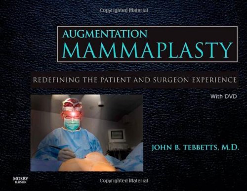 Augmentation Mammaplasty With Dvd Redefining The Patient And Surgeon Experience 1 Hardvd John B Tebbetts Md