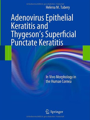 Adenovirus Epithelial Keratitis And Thygesons Superficial Punctate Keratitis In Vivo Morphology In The Human Cornea 1st Edition Helena M Tabery Auth