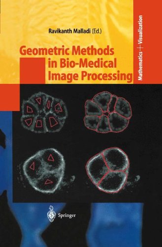 Geometric Methods In Biomedical Image Processing Ravikanth Malladi