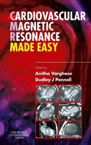 Cardiovascular Magnetic Resonance Made Easy 1st Edition Anitha Varghese Mbbs Bsc Mrcp