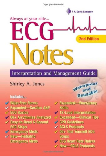 Ecg Notes Interpretation And Management Guide 2nd Edition Daviss Notes 2nd Edition Shirley A Jones