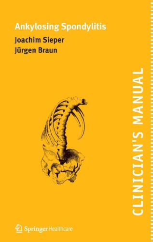 Clinicians Manual On Ankylosing Spondylitis Joachim Sieper Jurgen Braun