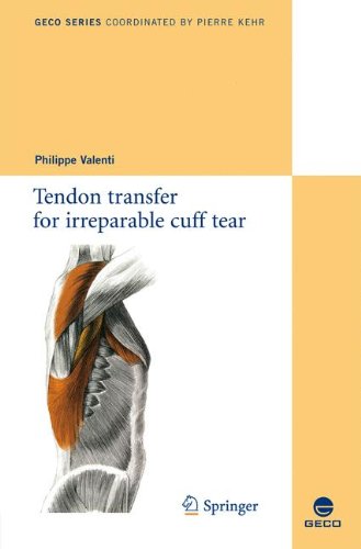 Tendon Transfer For Irreparable Cuff Tear Collection Geco 1st Edition Philippe Valenti