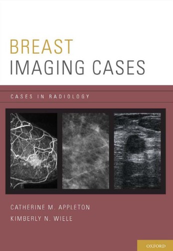 Breast Imaging Cases Cases In Radiology Catherine M Appleton