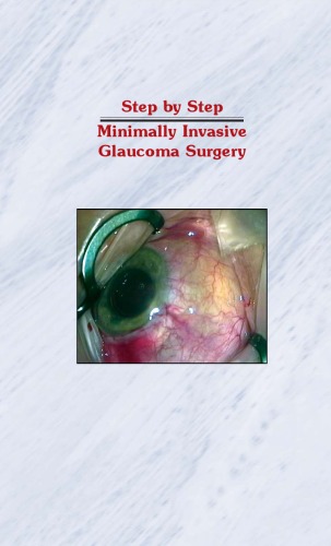 Step By Step Minimally Invasive Glaucoma Surgery 1st Edition Garg