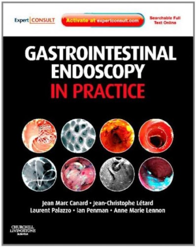 Gastrointestinal Endoscopy In Practice Expert Consult Online And Print Jean Marc Canard Md